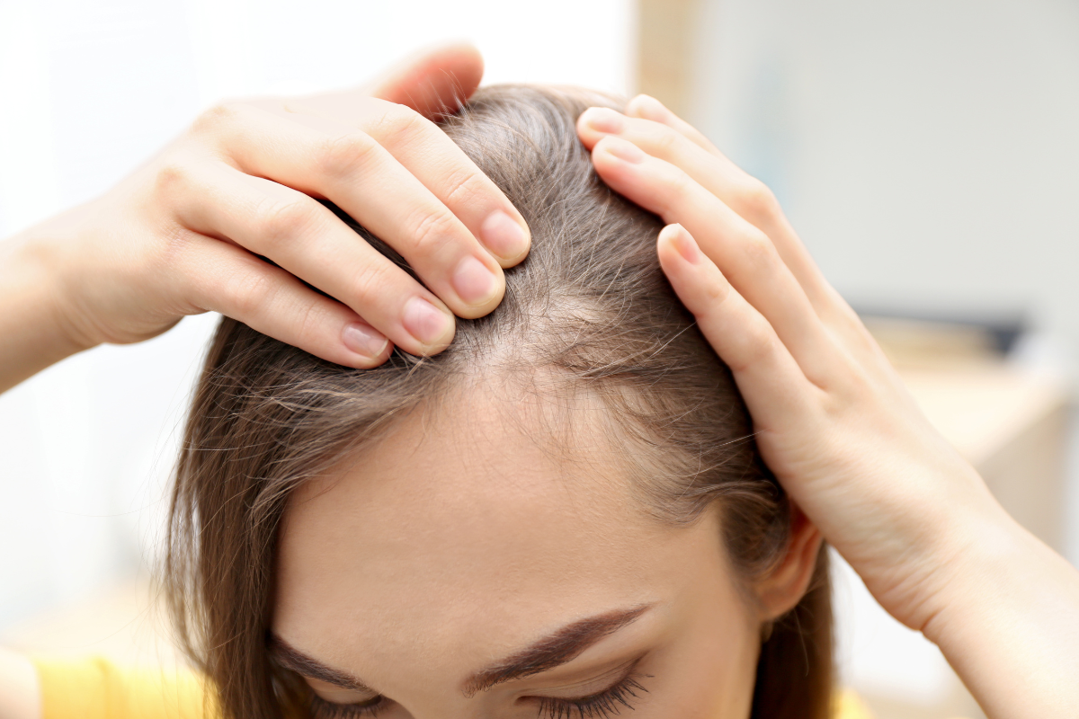 Kollagen, håravfall & tunt hår collagen hair loss thin hair celloptimum