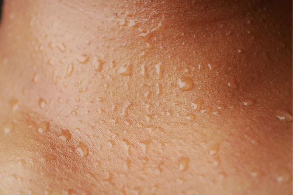 Kollagen och hudens hälsa – så fungerar det